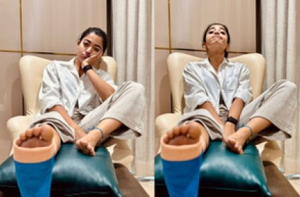 Rashmika Mandanna sustained leg injury, apologises to directors