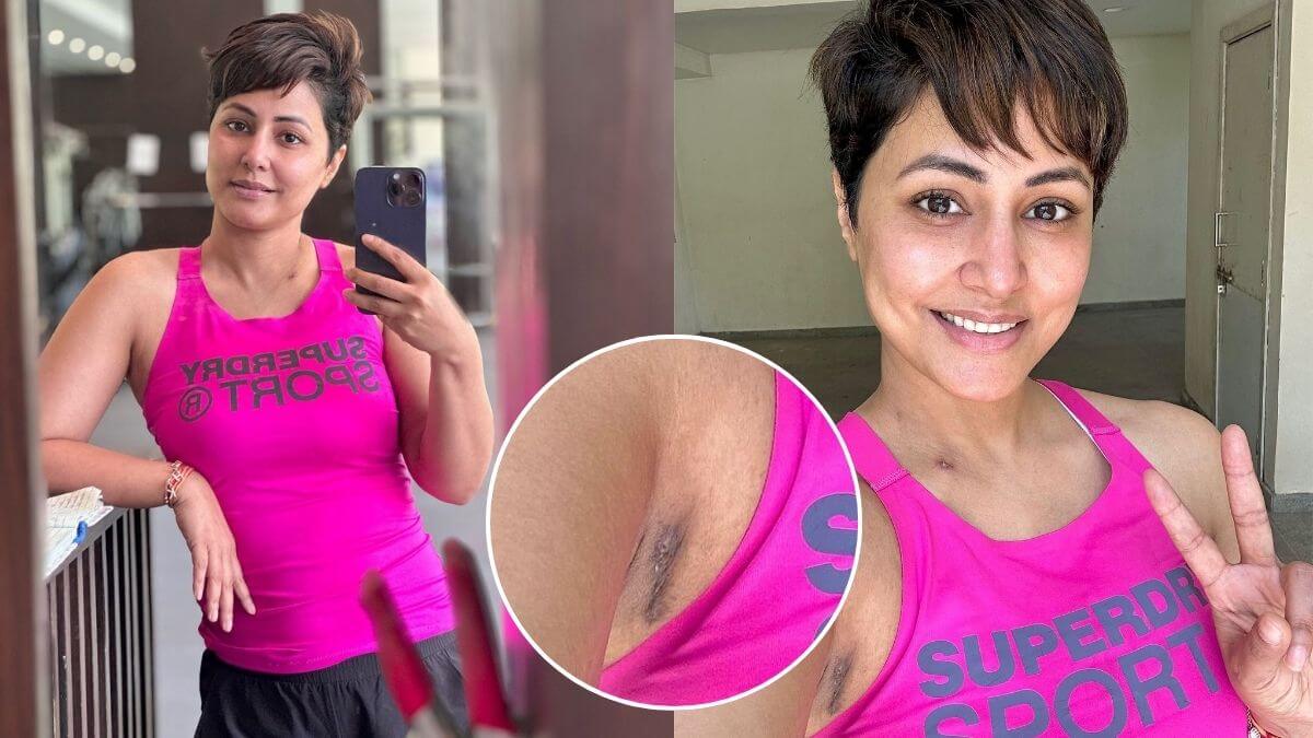Hina Khan shares photos displaying chemotherapy scars, says 