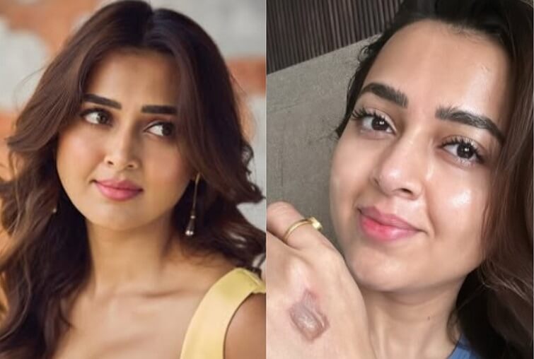 TV actor Tejasswi Prakash injured on sets of Celebrity MasterChef 