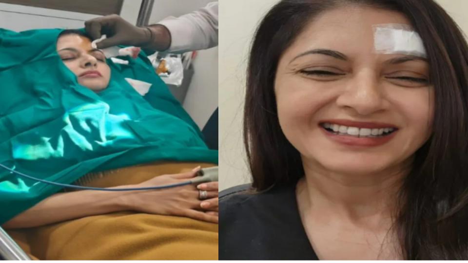 Bhagyashree gets injured while playing pickleball, gets 13 stitches on forehead