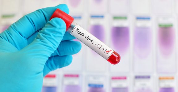 Kerala on high alert after teen tests positive for Nipah virus 