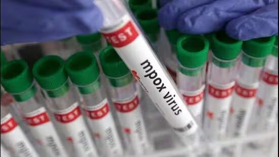 India develops indegenous RT-PCR testing kit for Mpox