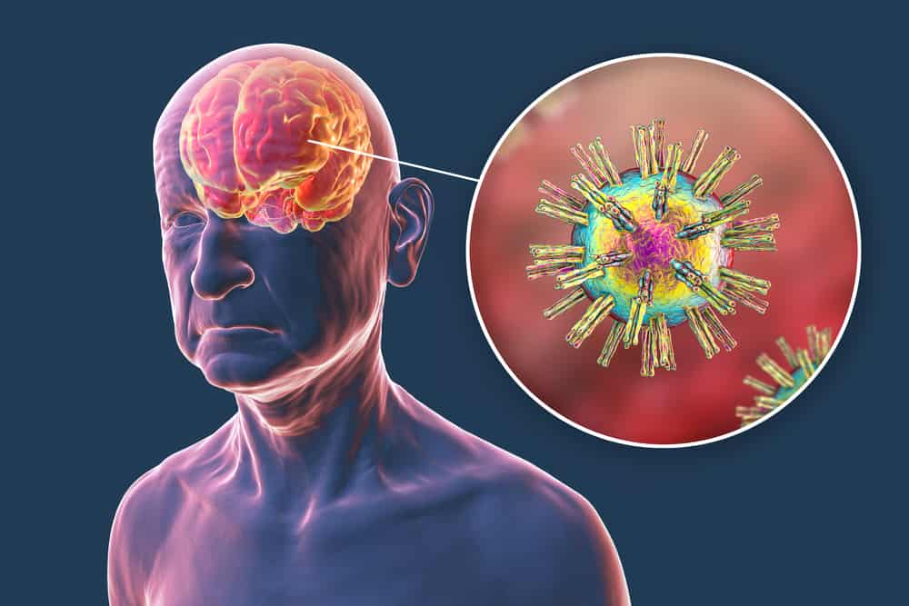 Scientists discover common virus could be causing Alzheimer