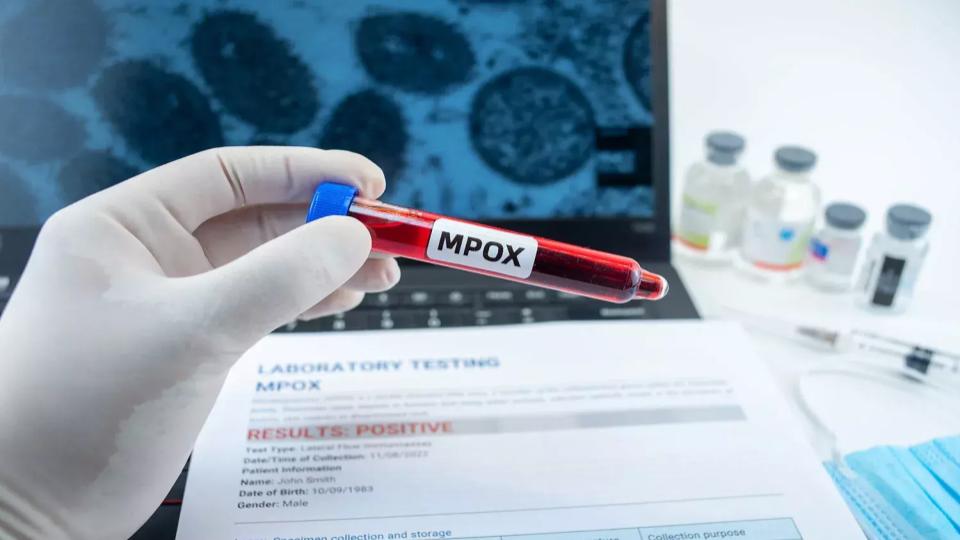 Centre advises screening, testing, and isolation for suspected Mpox cases