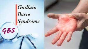 Guillain–Barre Syndrome: Two succumb in Andhra in 10 days