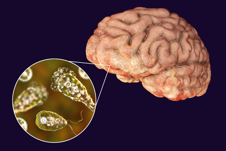Kerala reports fourth case of rare brain-eating amoeba infection